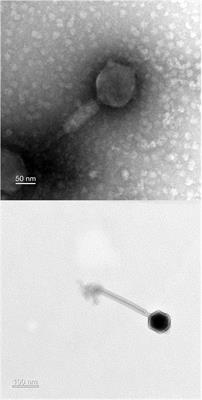 Characterization and Genomic Analysis of PALS2, a Novel Staphylococcus Jumbo Bacteriophage